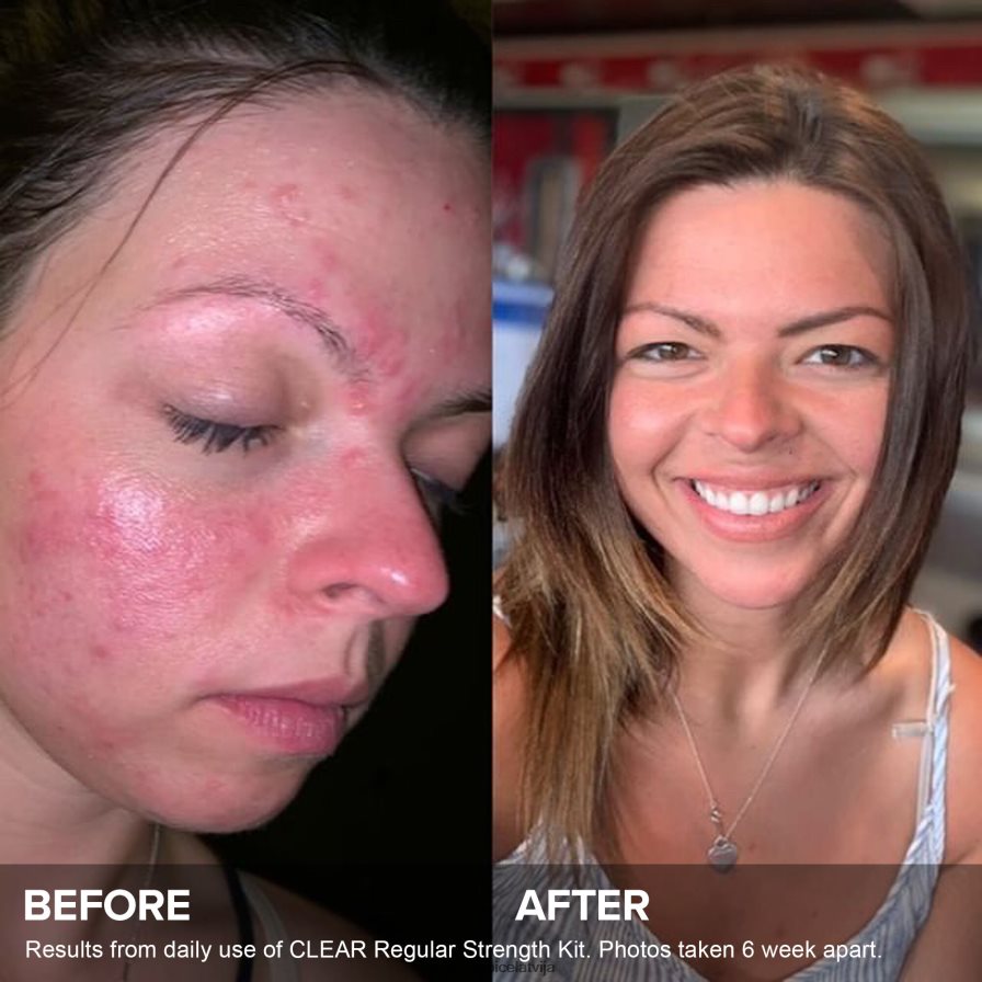 Paula's Choice LVL8VT8 papildu spēka komplekts 3 soļu rutīna